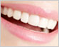 WHITENING KNOW-HOW